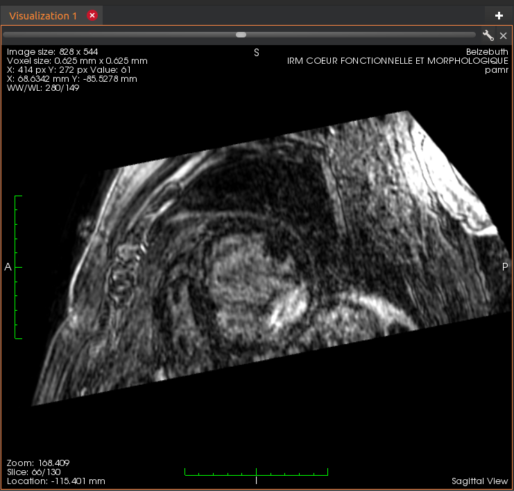 a view with data