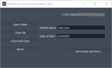 MUSIC Anonymizer