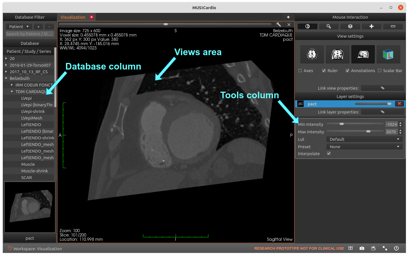 Visualization Workspace